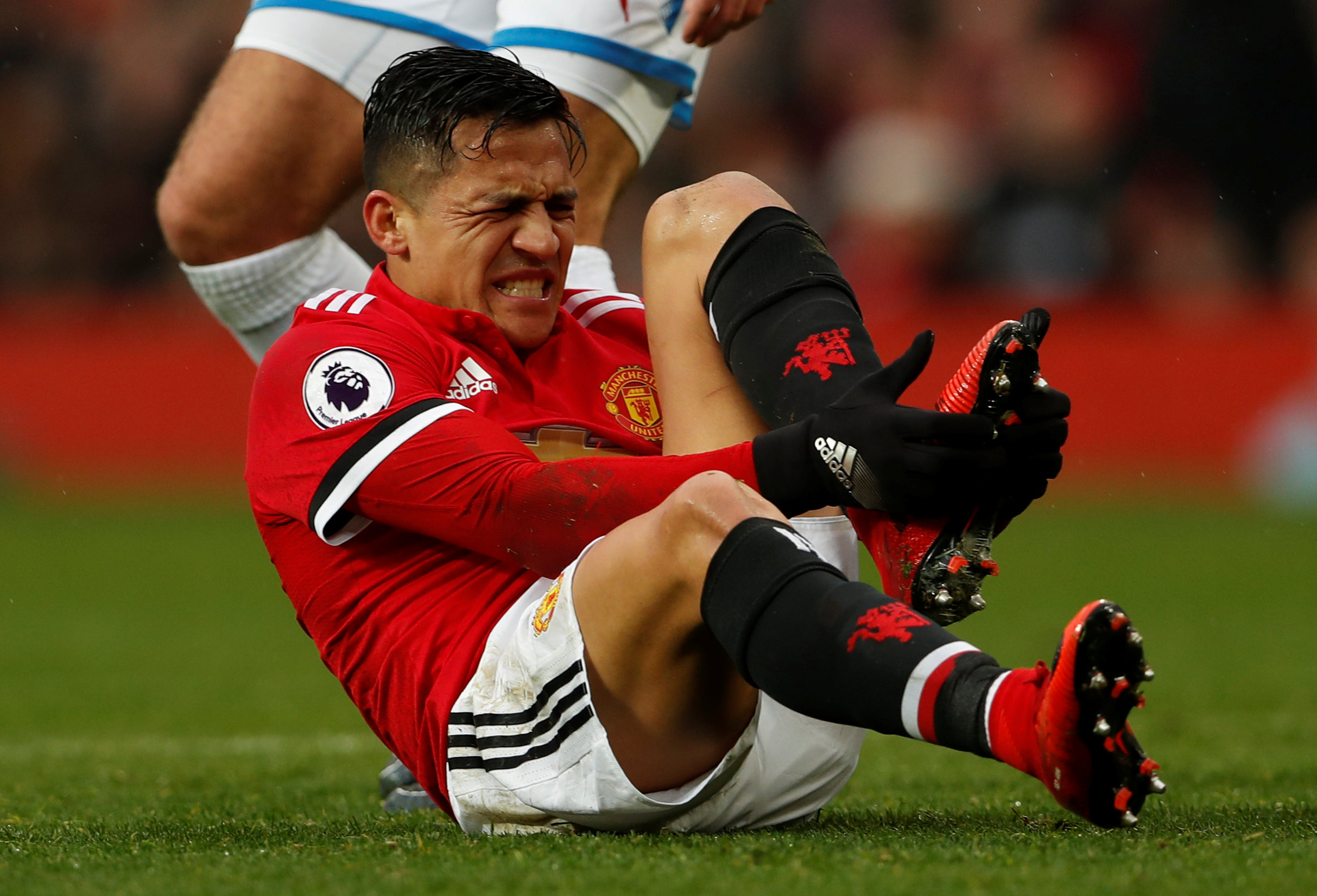 Sports Injury Bulletin Anatomy Fractures of the Proximal 5th