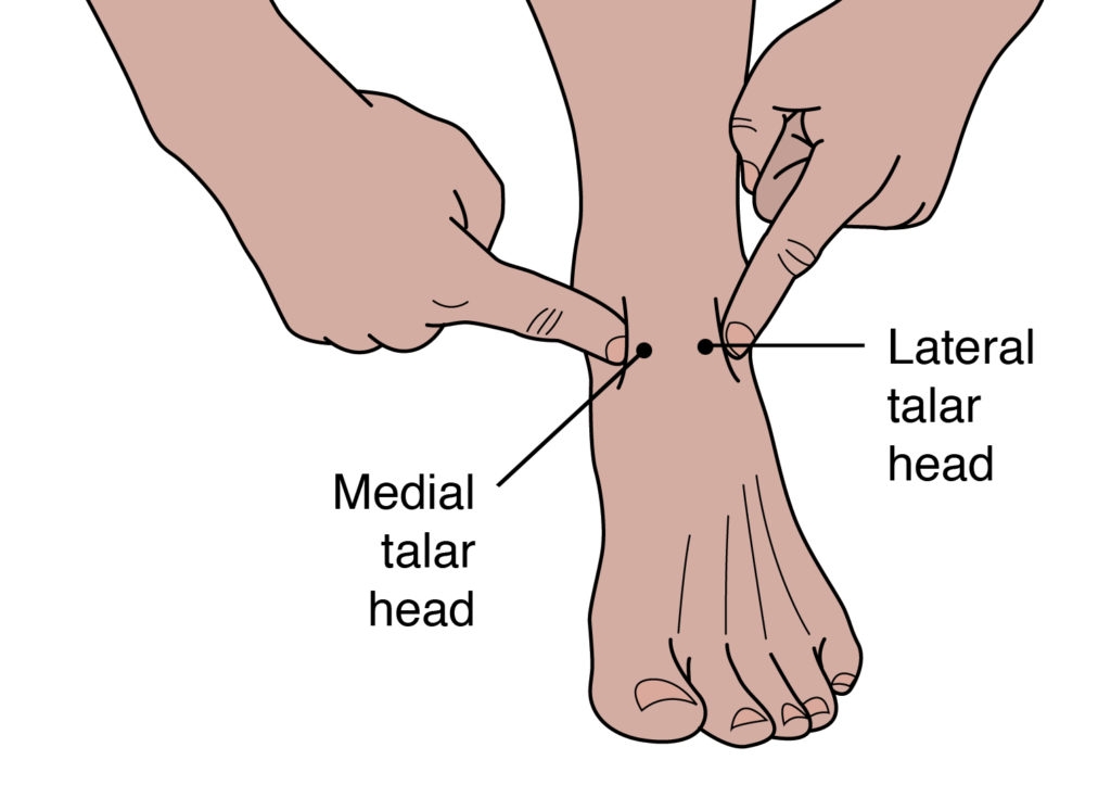 Figure 3: Palpating medial talar head