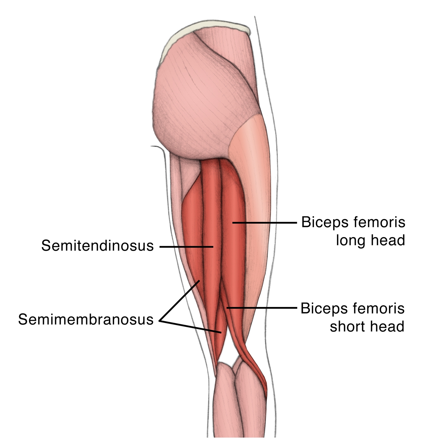 Box 1: The hamstring muscles with the arrow indicating the primary location for pain in HHT