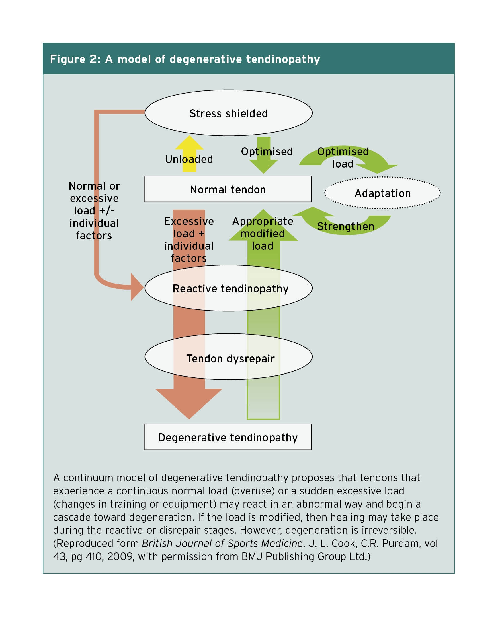 A continuum model of degenerative tendinopathy proposes that tendons that experience a continuous normal load (overuse) or a sudden excessive load (changes in training or equipment) may react in an abnormal way and begin a cascade toward degeneration. If the load is modified, then healing may take place during the reactive or disrepair stages. However, degeneration is irreversible. (Reproduced form British Journal of Sports Medicine. J. L. Cook, C.R. Purdam, vol 43, pg 410, 2009, with permission from BMJ Publishing Group Ltd.)