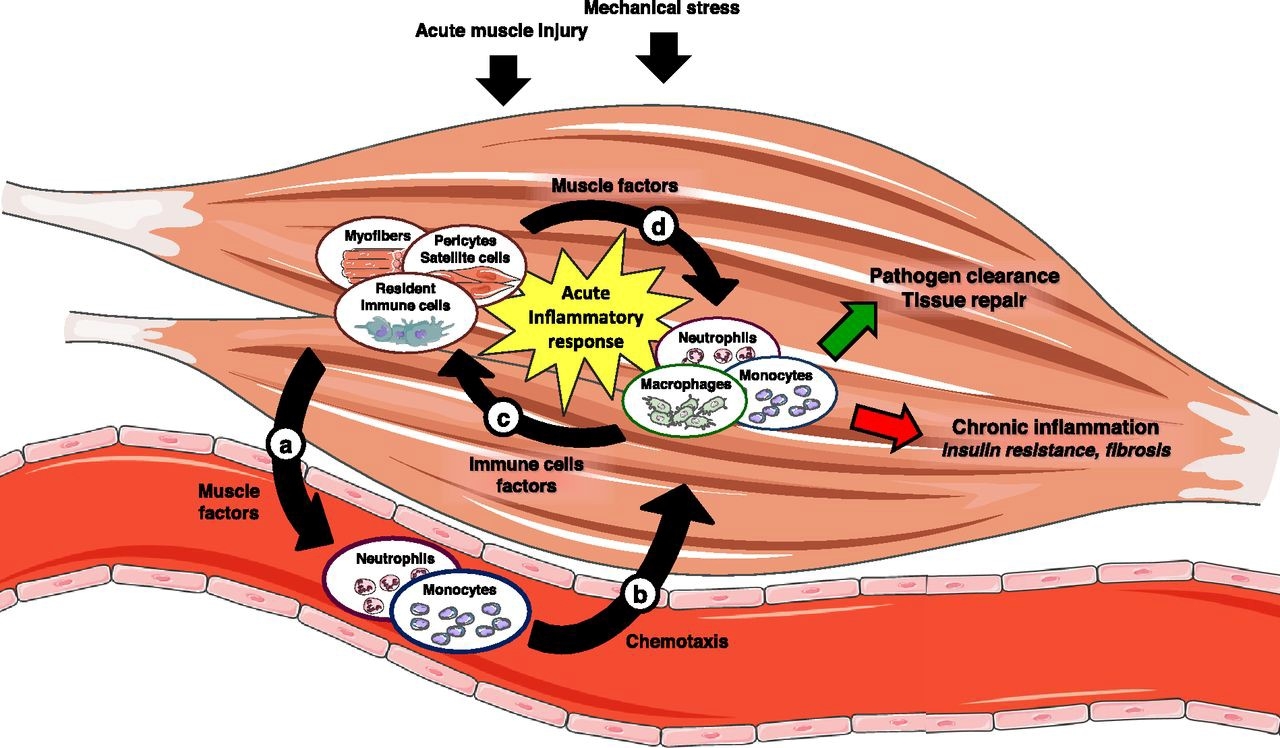 Muscle inflammatory responses and macrophage cross-talk in response to acute muscle injury and/or, mechanical stress – eg exercise – activate the transcription factors NF-βB and/or c-Jun/AP-1, leading to expression and secretion of muscle factors (eg chemokines and non-protein mediators). These compounds in turn are responsible for the recruitment of immune cells from the circulation (neutrophils, monocytes) into the muscle. Once in the tissue, the infiltrating and resident immune cells produce additional factors that reciprocally affect the muscle. This leads to the acute inflammatory response necessary for pathogen clearance and tissue repair (green arrow).