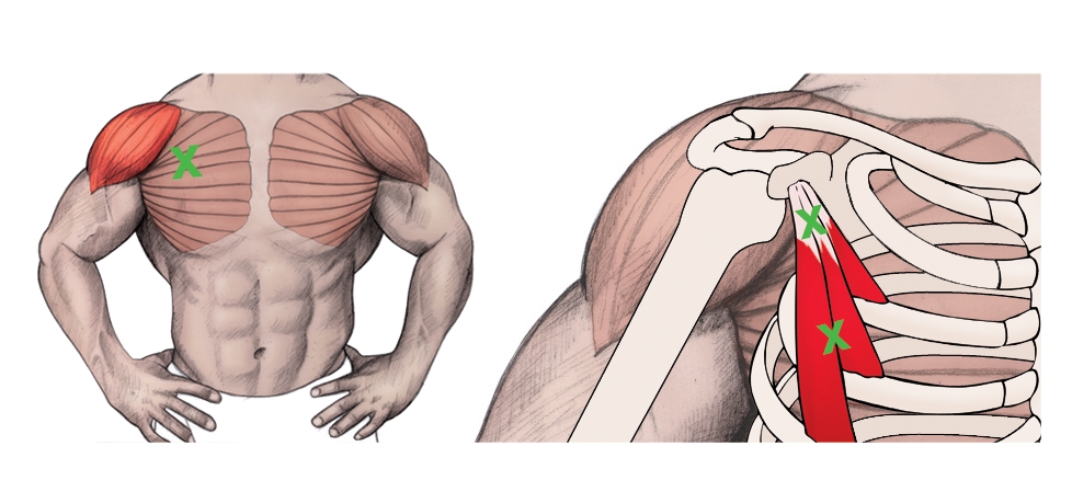 Figure 3: Trigger Points in the PMi