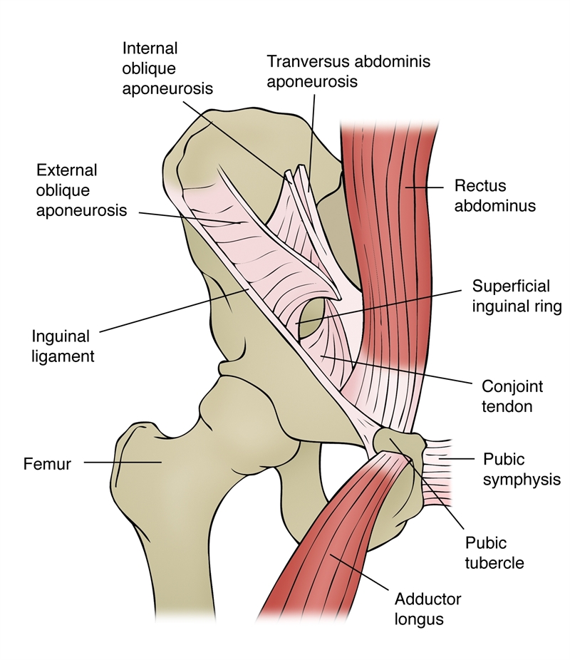 Figure 1: Simplified diagram of groin anatomy