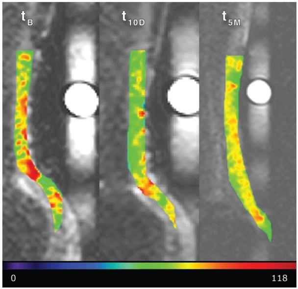 Left = pre-Ciprofloxacin, middle = after 10 days of Ciprofloxacin, right = 5 months later. Red/orange areas indicate high GAG levels in the tendon; green = lower levels