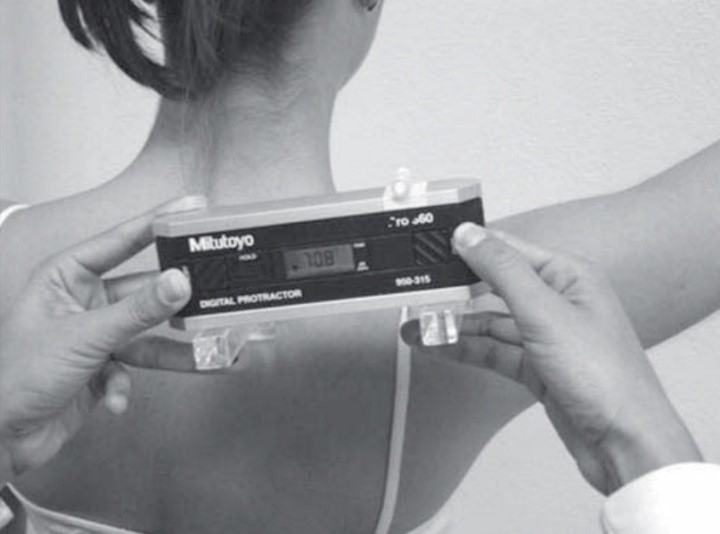 Figure 1: Measuring scapular rotation