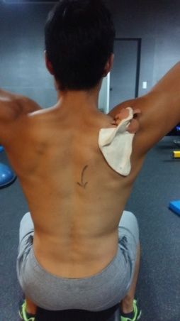 Figure 6a: Scapula setting in vertical elevation (start position)