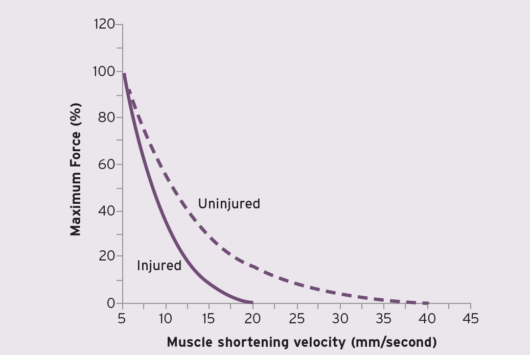 Comparison of an uninjured muscle and an injured muscle. The injured muscle with shorter fasicles has a much lower shortening velocity.